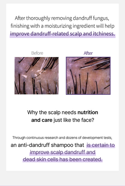 ROOTONIX Anti-Dandruff Shampoo – 500ml Mayson Essentials Pte Ltd