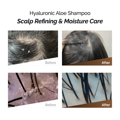 ROOTONIX Blue Xylitol Shampoo For Oily Scalp – 500ml Mayson Essentials Pte Ltd