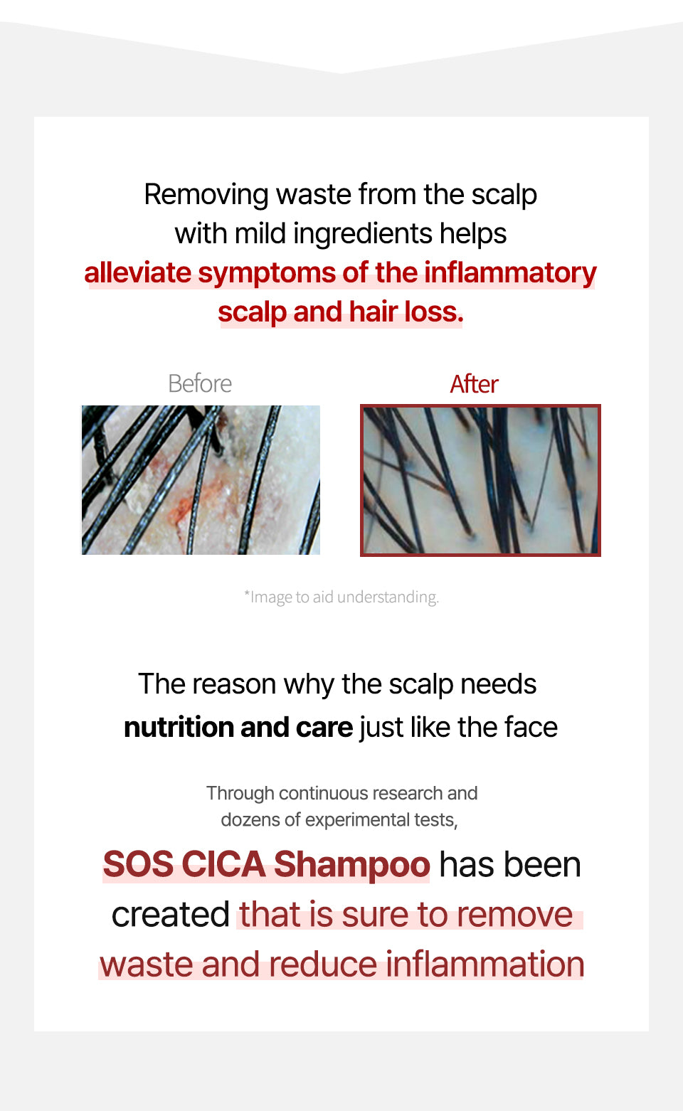 ROOTONIX SOS Cica Scalp Care Shampoo 500ml Mayson Essentials Pte Ltd