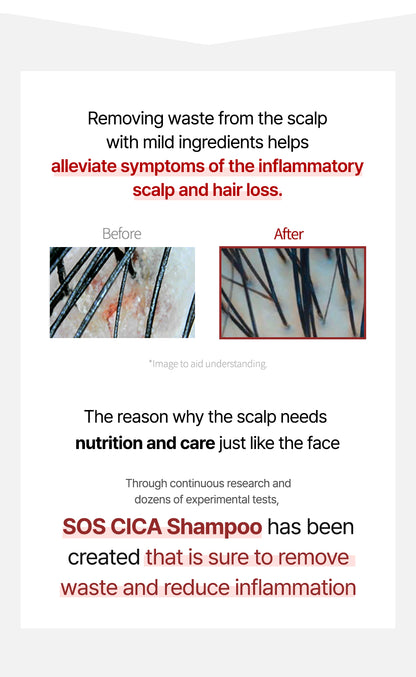 ROOTONIX SOS Cica Scalp Care Shampoo 500ml Mayson Essentials Pte Ltd