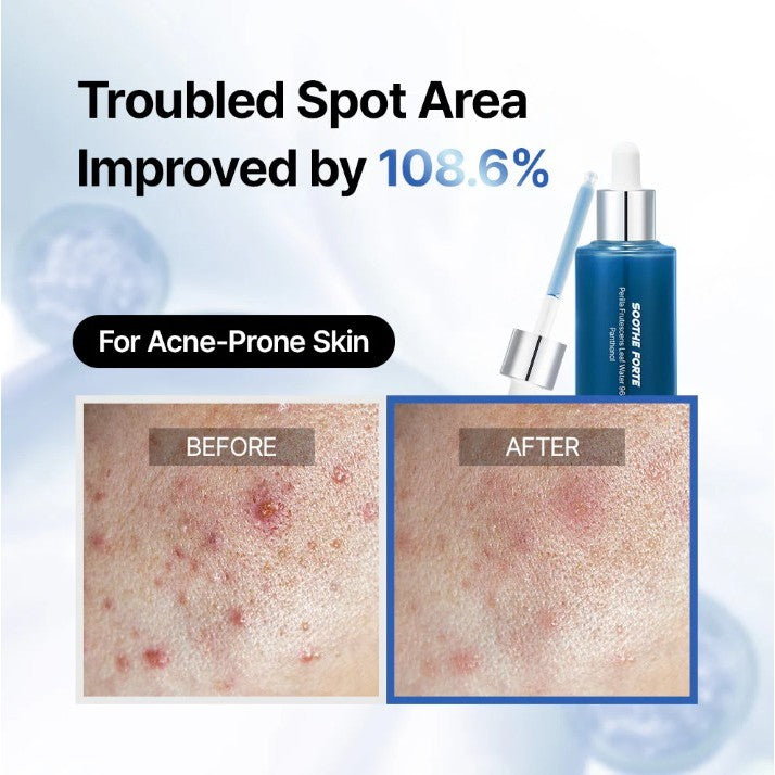 Essenciel Soothe Forte Serum 50ml MaysonBeauty