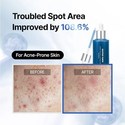 Essenciel Soothe Forte Serum 50ml MaysonBeauty